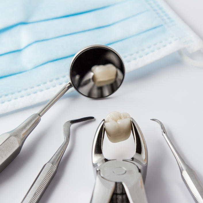 Tooth Extractions - Dental Services